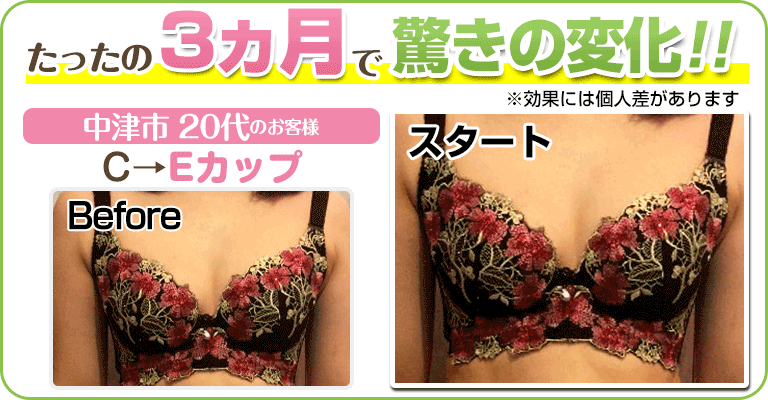 下関 ビフォーアフター画像