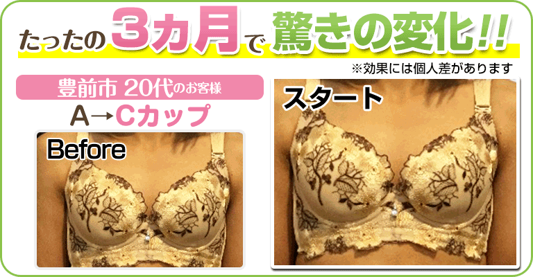 下関 ビフォーアフター画像