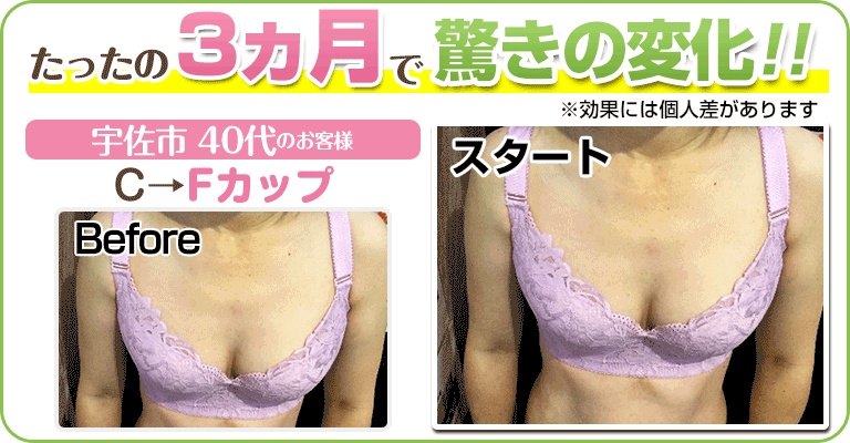 下関 ビフォーアフター画像