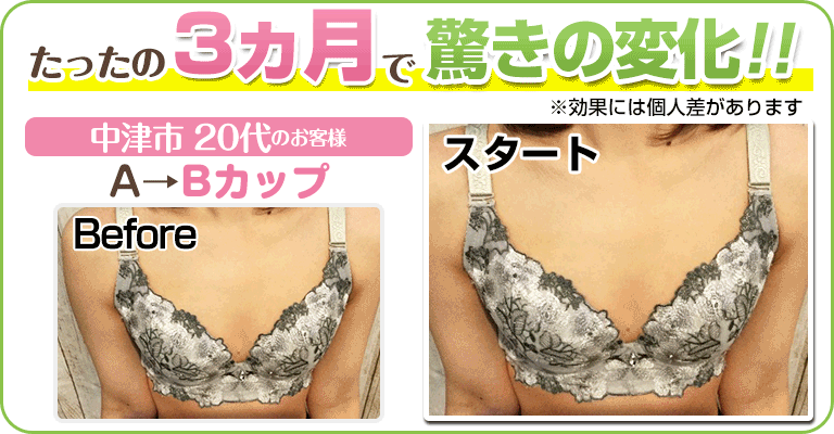 下関 ビフォーアフター画像
