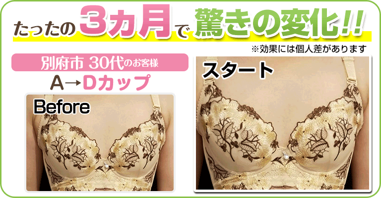 下関 ビフォーアフター画像