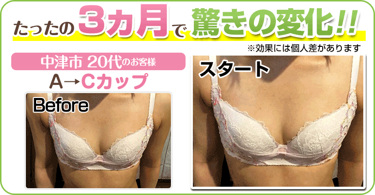 下関 ビフォーアフター画像