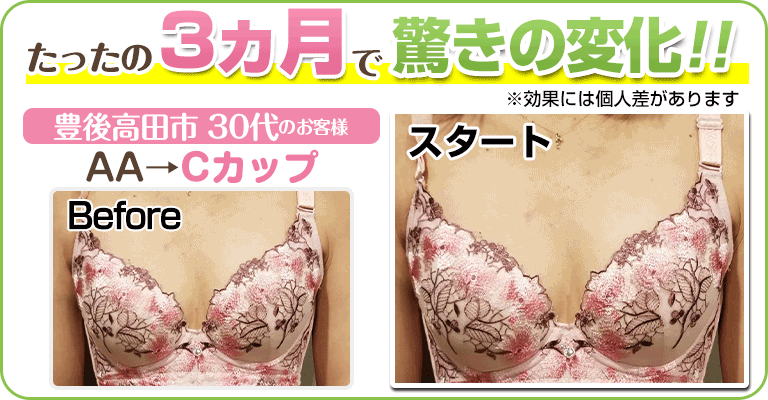下関 ビフォーアフター画像