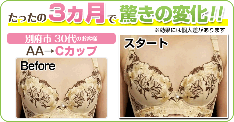 下関 ビフォーアフター画像