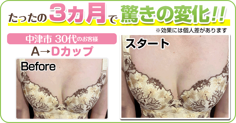 下関 ビフォーアフター画像