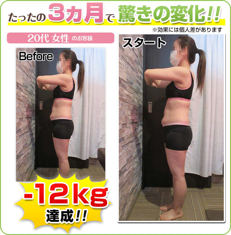 下関 ダイエットビフォーアフター