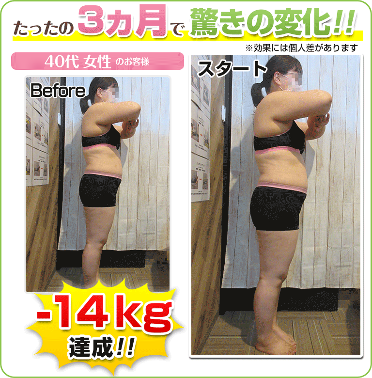 下関 ダイエットビフォーアフター