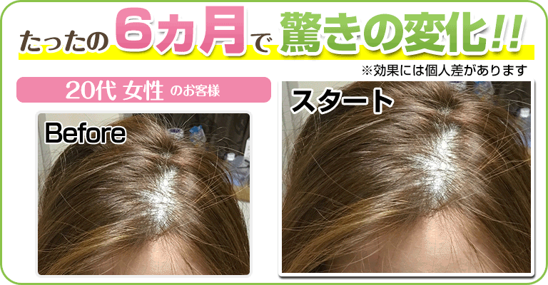 下関 ビフォーアフター