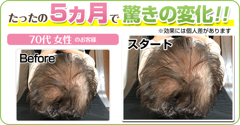 下関 ビフォーアフター
