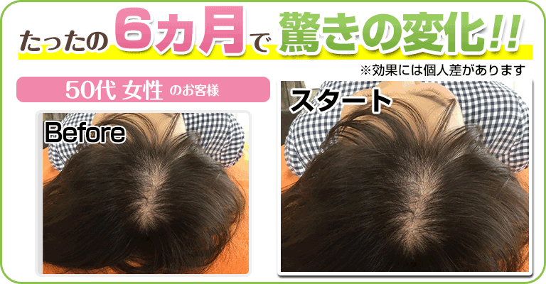 下関 ビフォーアフター