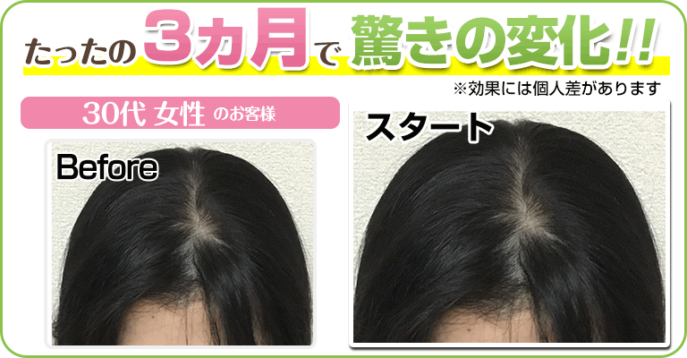 下関 ビフォーアフター
