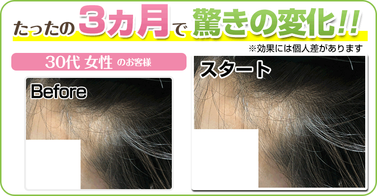 下関 ビフォーアフター