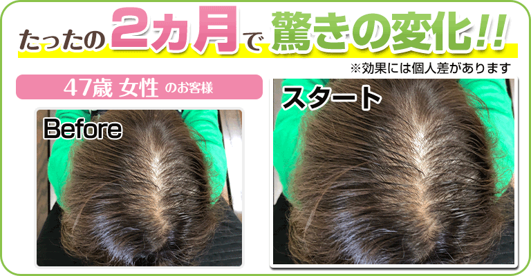 下関 ビフォーアフター