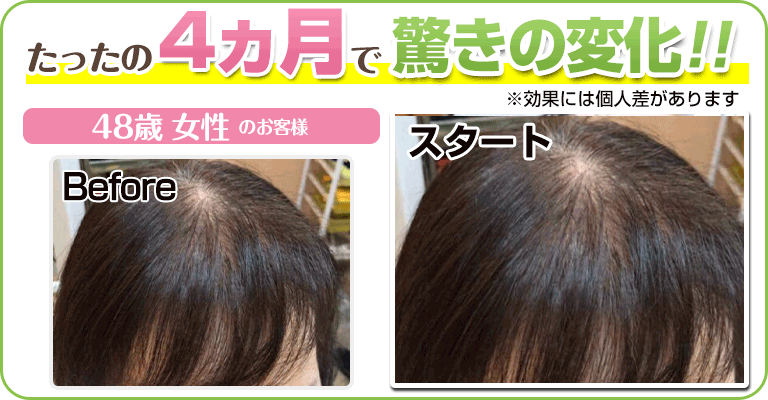 下関 ビフォーアフター