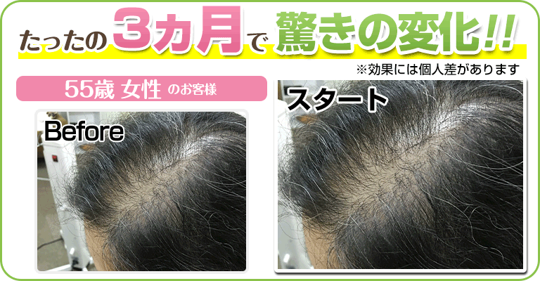 下関 ビフォーアフター