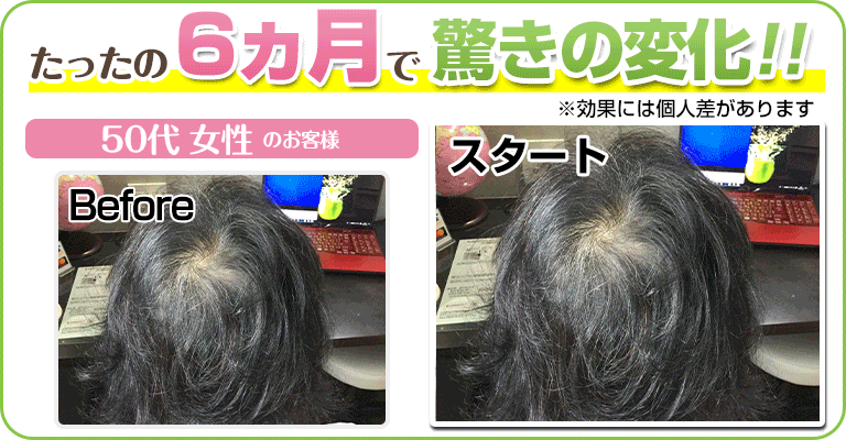 下関 ビフォーアフター