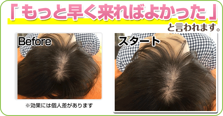 下関 ビフォーアフター