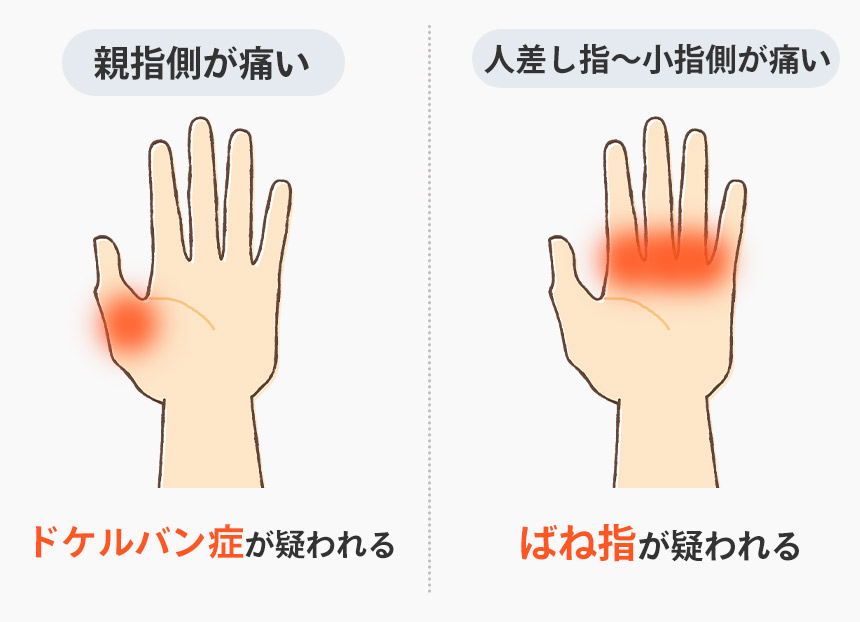 下関 腱鞘炎 タイプ