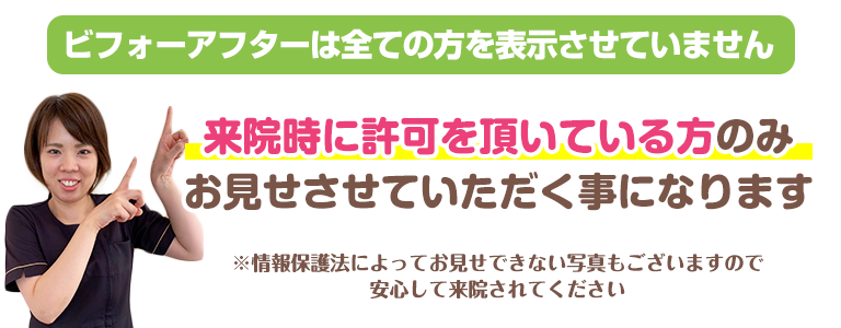 下関 許可を頂いてる方のみ