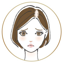 下関 びまん性脱毛