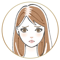 下関 女子男性型脱毛症