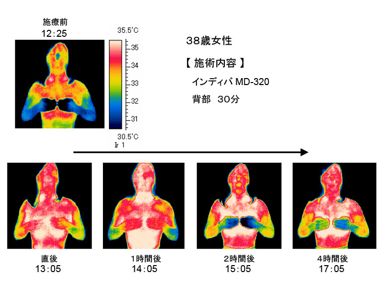 下関 サーモグラフィー画像Ａ