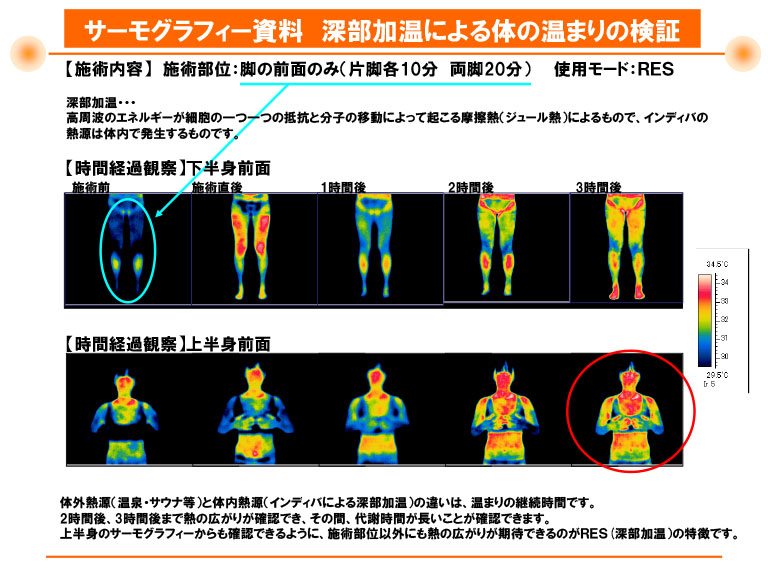 下関 サーモグラフィー画像Ｂ