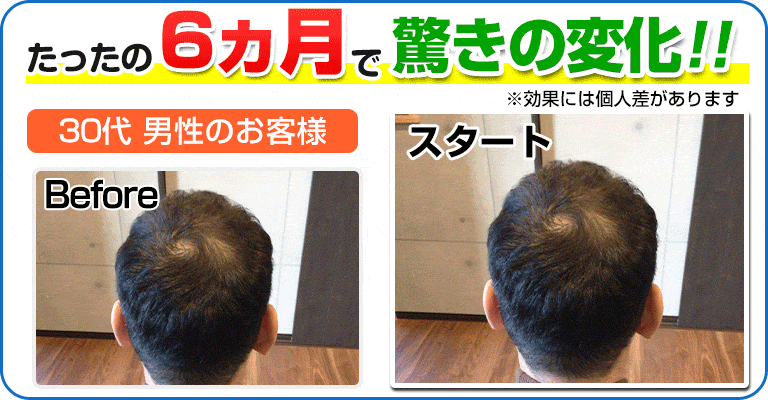 下関 ビフォーアフター