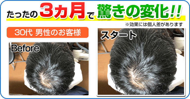 下関 ビフォーアフター