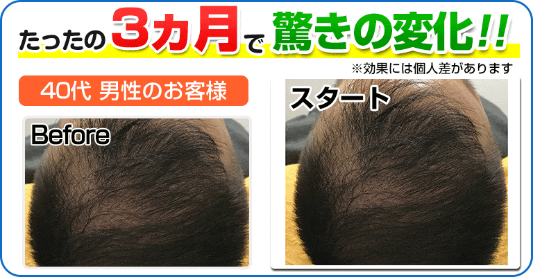 下関 ビフォーアフター