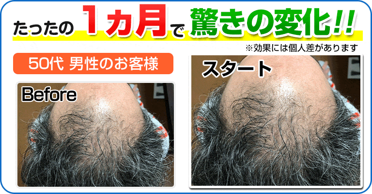 下関 ビフォーアフター